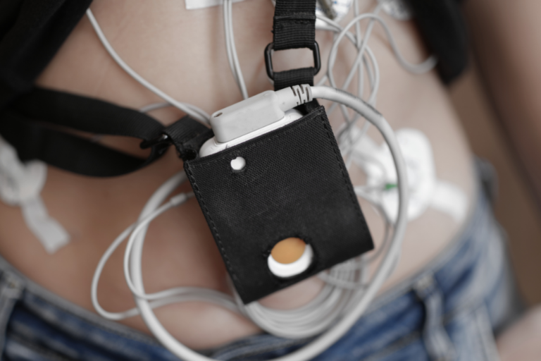 Holter EKG podłączony do pacjenta monitorujący pracę serca